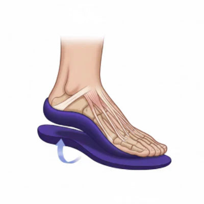 Arch Support